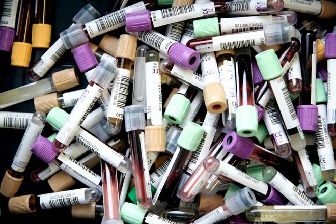 Plastiche contaminate da laboratori e ospedali, ma come avviene il riciclo?