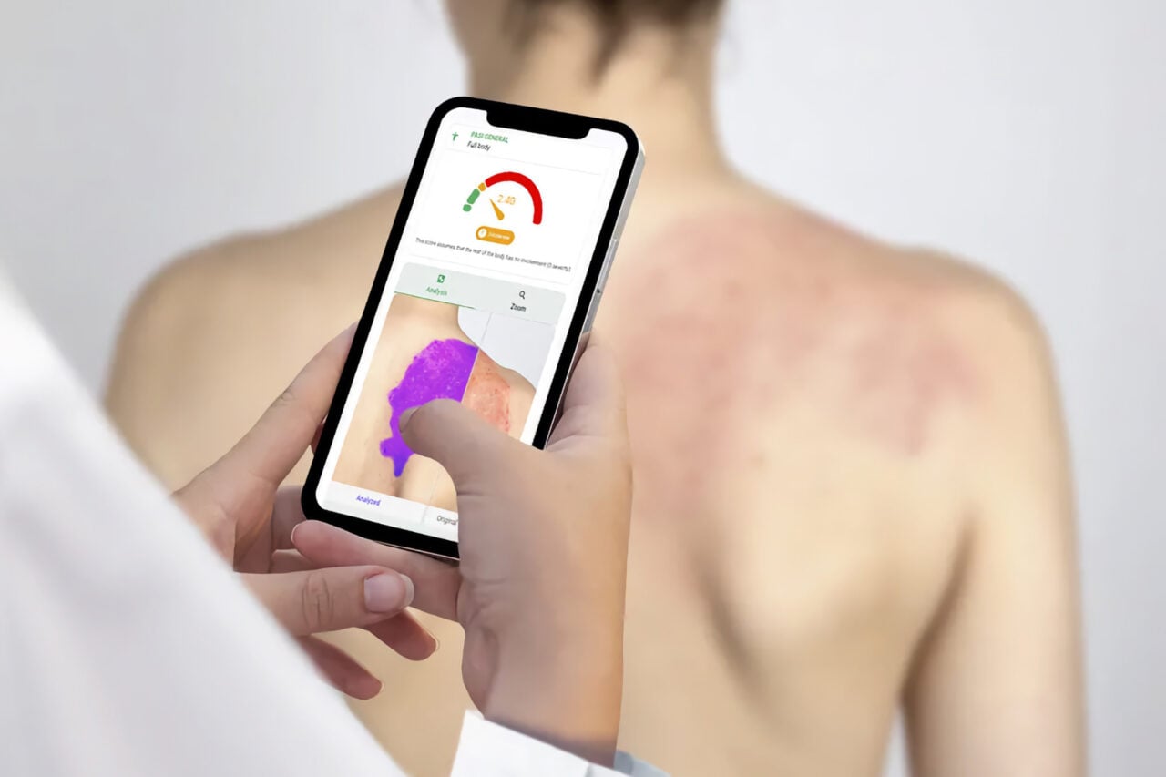 Une simple photo de la peau pour réduire la file d’attente chez le dermato